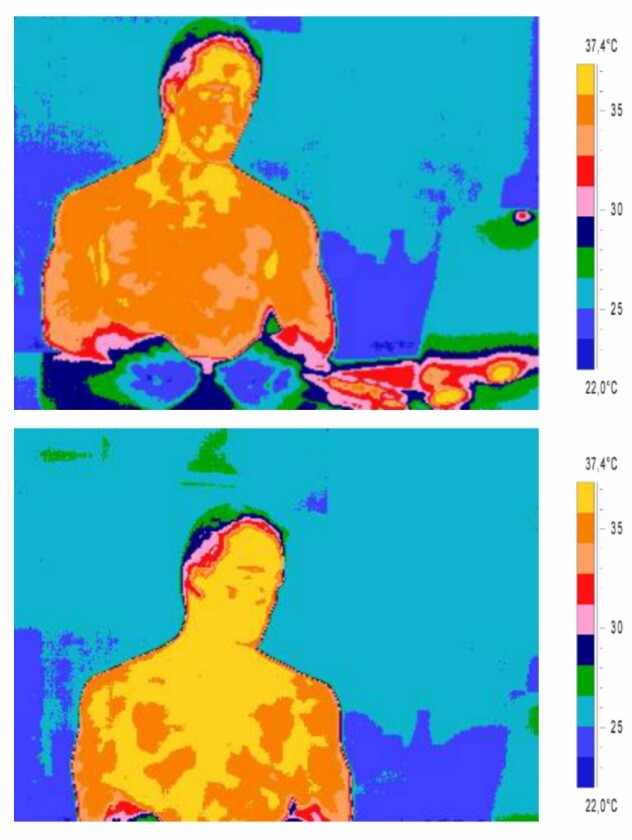 A test subject's baseline thermal reading (top), and one taken as they view images of a lover (bottom)