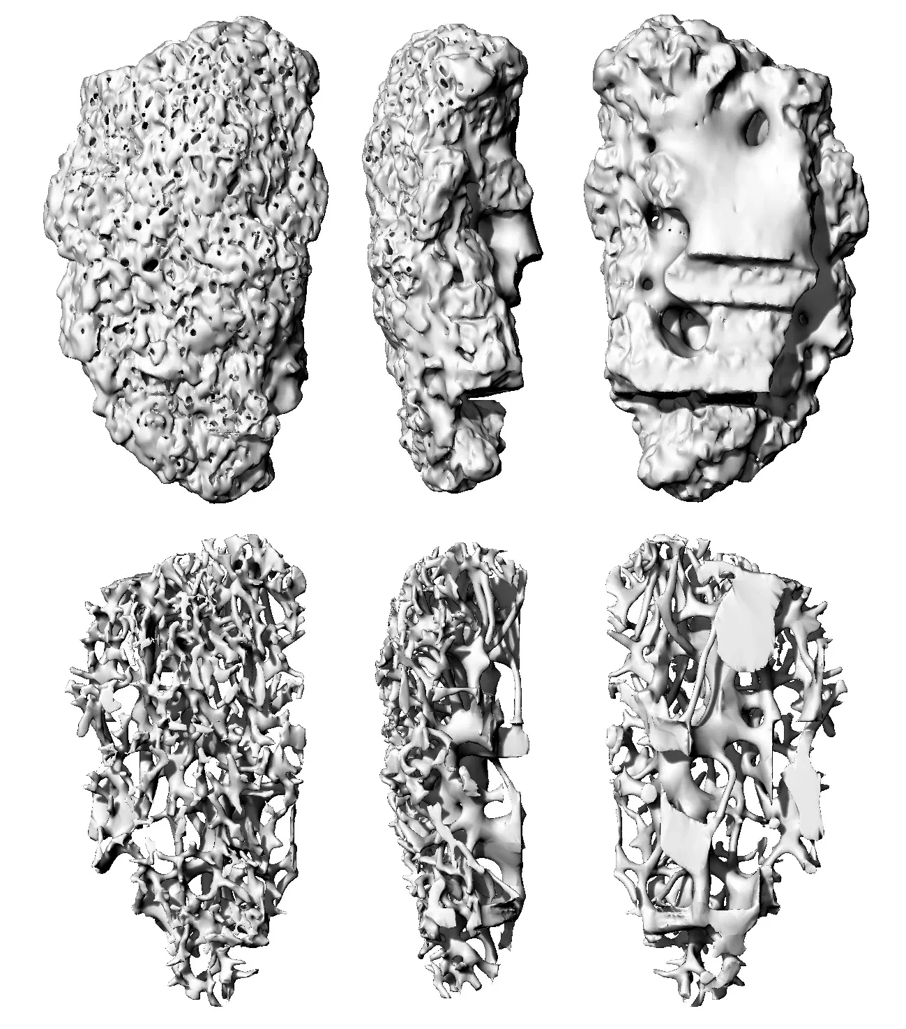 Computed tomography (CT) scan of the egress complex