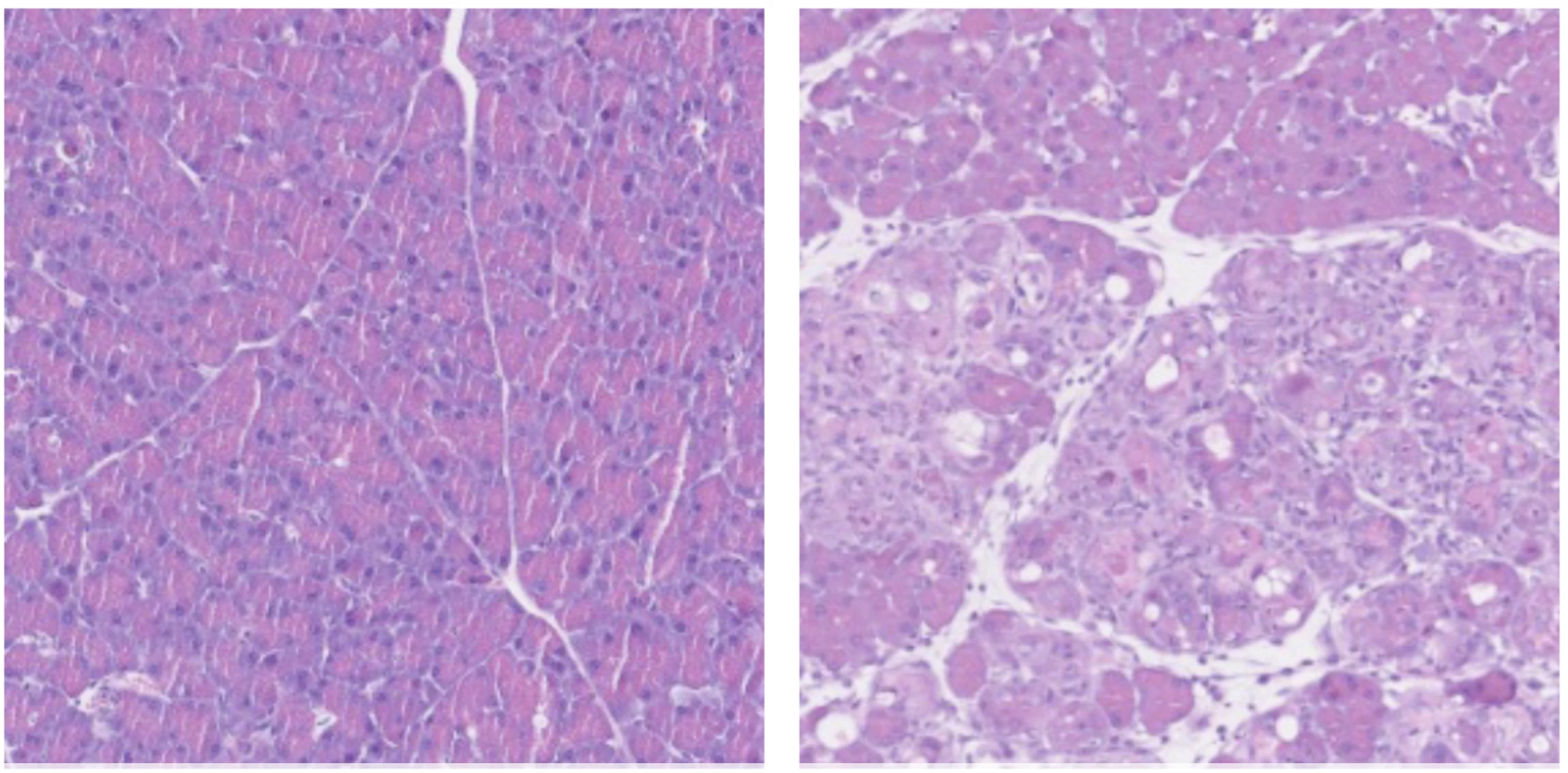 Normal pancreatic cells (left) undergo reprogramming (right) when boosted by B12
