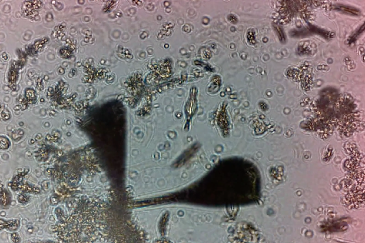 IBM Research scientists have developed a way to monitor the health and behavior of plankton, to get an understanding of the overall health of a water system