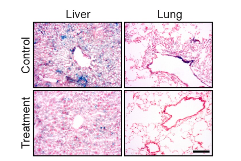 The blue staining shows senescent cells in lung and liver tissue. The amount of the staining is significantly reduced following the drug treatment