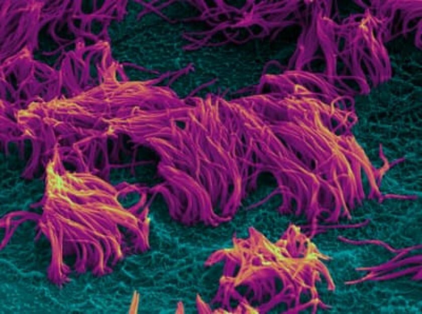 The airway cells seen through a microscope, including the cilia that transport mucus