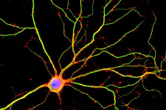 A neuron with the dendrites shown in green