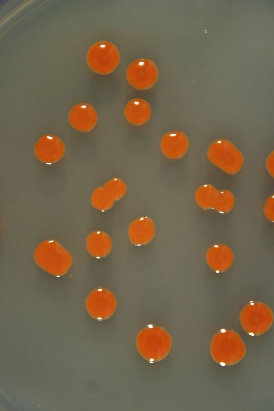 Sarcinaxanthin-producing bacteria on agar plates in the laboratory (Photo: Credit Geir Klinkenberg, SINTEF)