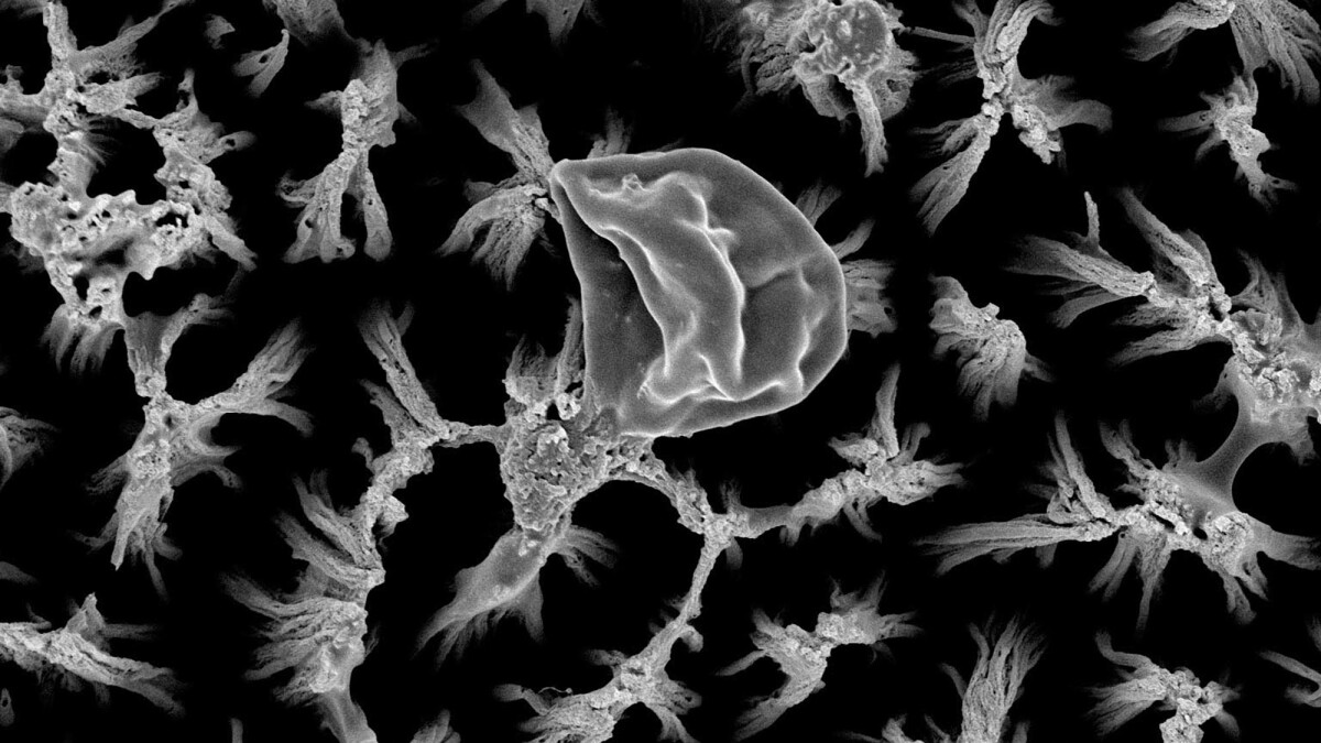 Titanium spikes kill superbugs drug-free by literally ripping them apart - Vimarsana News