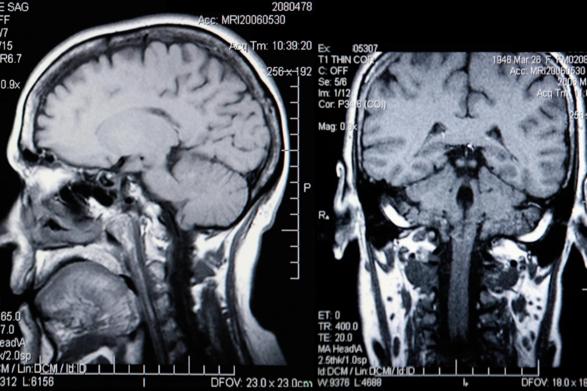 When it comes to determining our biological age, size matters