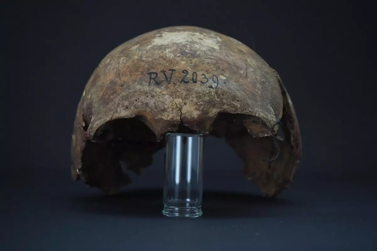 The skull of RV 2039, a hunter-gatherer buried in Latvia around 5,000 years ago