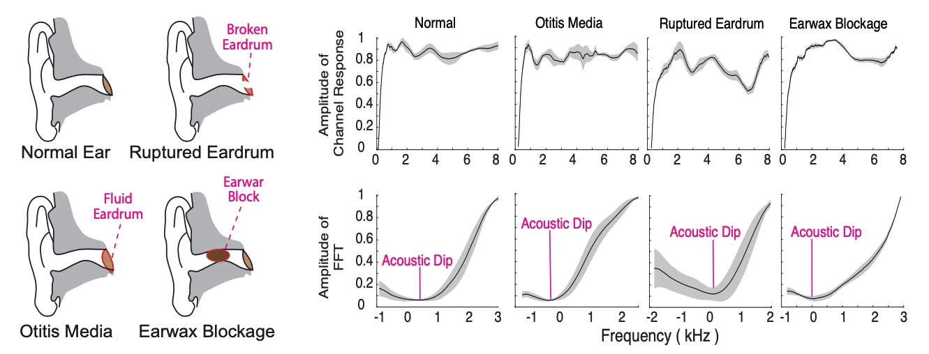 Four different conditions the researchers have identified that alter the returned audio signal in a way the deep learning system can recognize and diagnose at over 80% accuracy