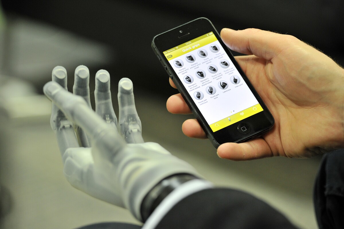 The i-limb is controlled by a smartphone app