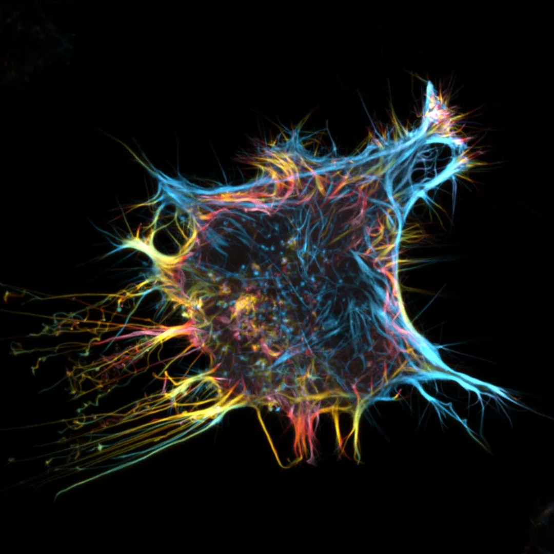 Image of Distinction: Fluorescent actin protein in a living HeLa cell