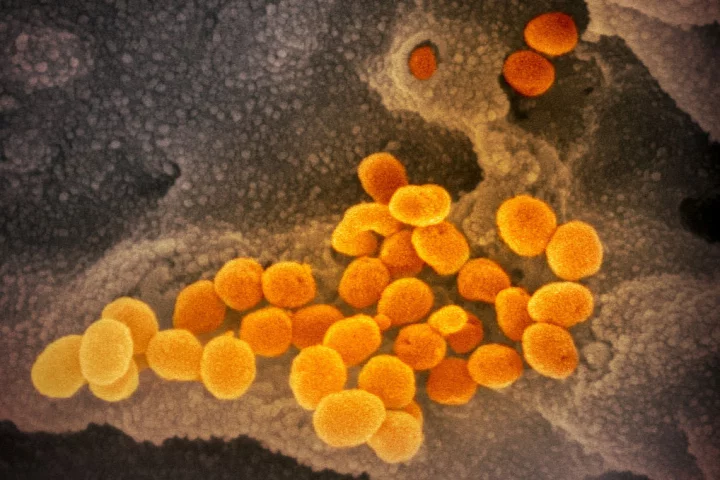 SARS-Cov-2 particles colored orange, emerging from cells colored gray