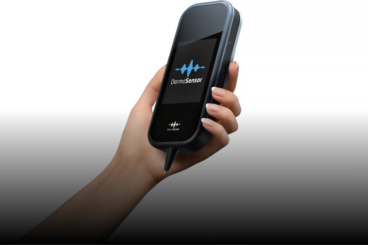 The FDA has granted clearance to an AI-powered device that helps physicians detect skin cancers