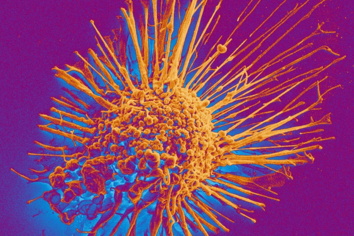 An electron microscopy image of a cancer cell produced at the University of Basel