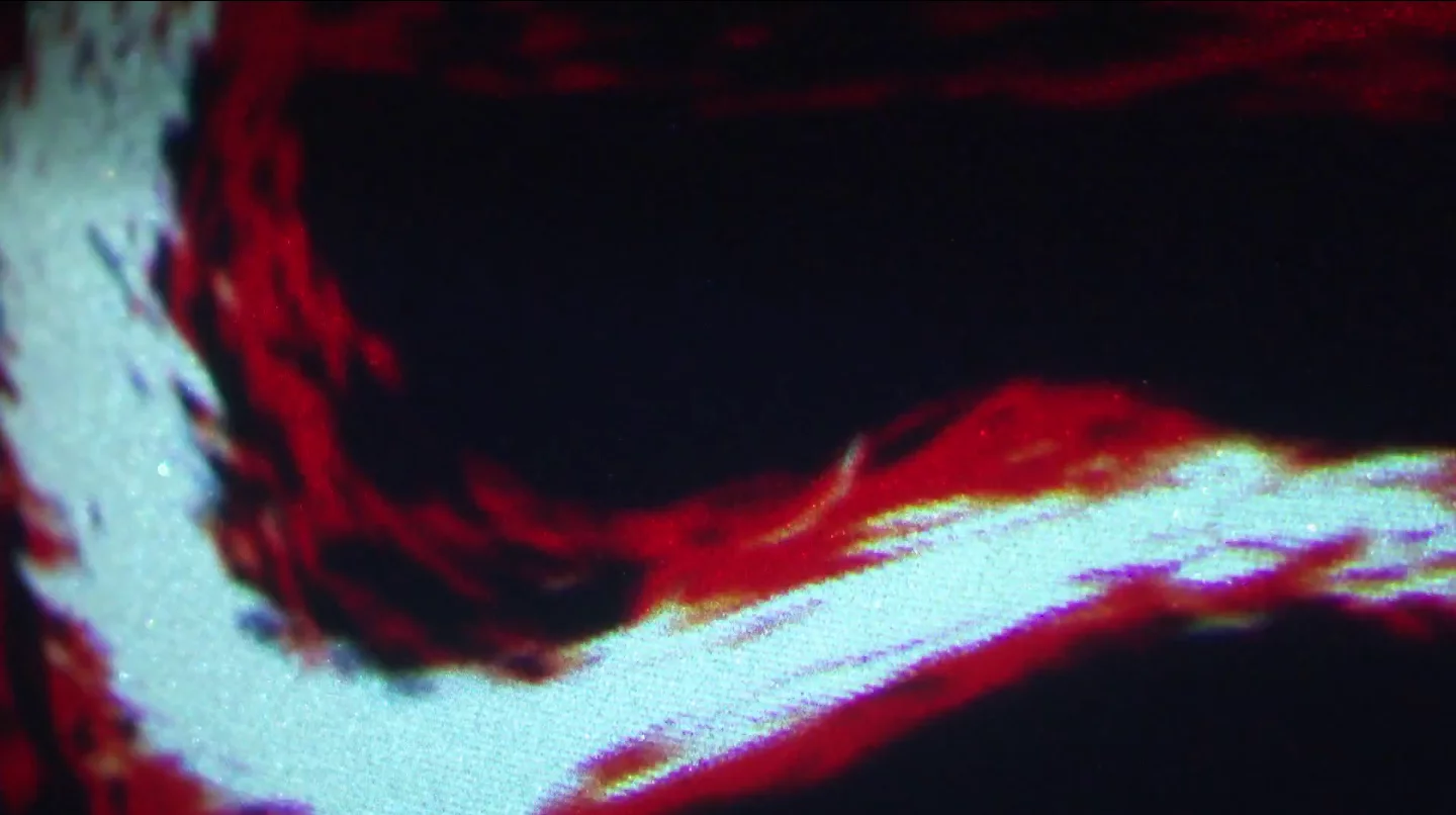 Some have raised concerns that the patterns could be distracting