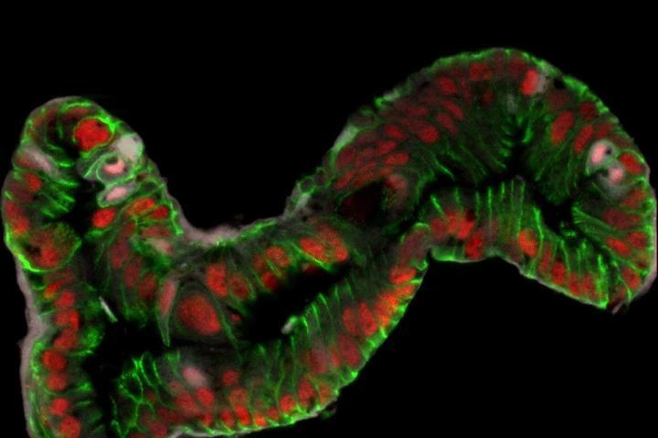 In a world first, scientists from Cincinnati Children's Hospital Medical Center have created functioning fetal intestinal tissue from pluripotent stem cells (Image: Jason Spence)