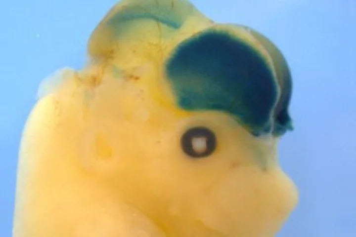 The mouse embryo developed a giant brain after being injected with the human version of a DNA sequence called HARE5 (Image: Silver lab, Duke University)