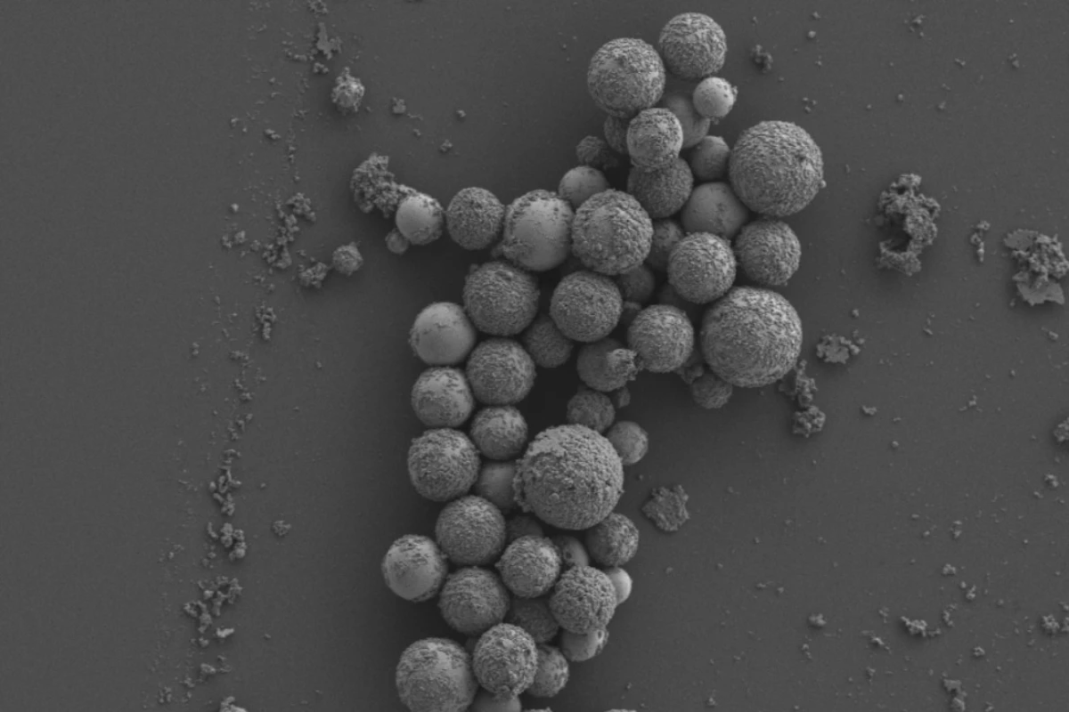 A microscope image of the liquid metal nanoparticles, which may be a promising new form of treatment against antibiotic-resistant bacteria