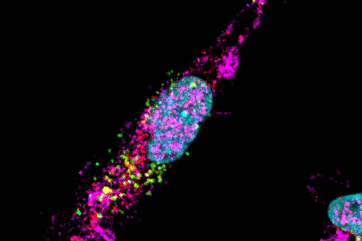 Researchers have discovered how red blood cells interact with white blood cells called macrophages to reduce the formation of fatty deposits on arterial walls