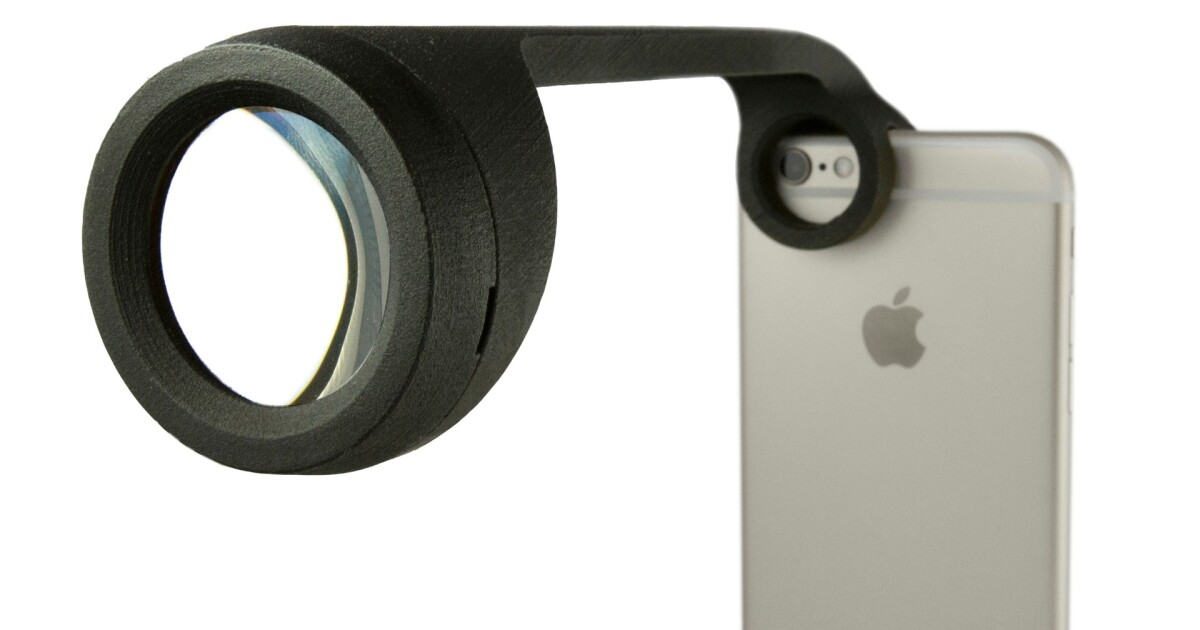 Addons let iPhones perform anterior and retinal eye exams