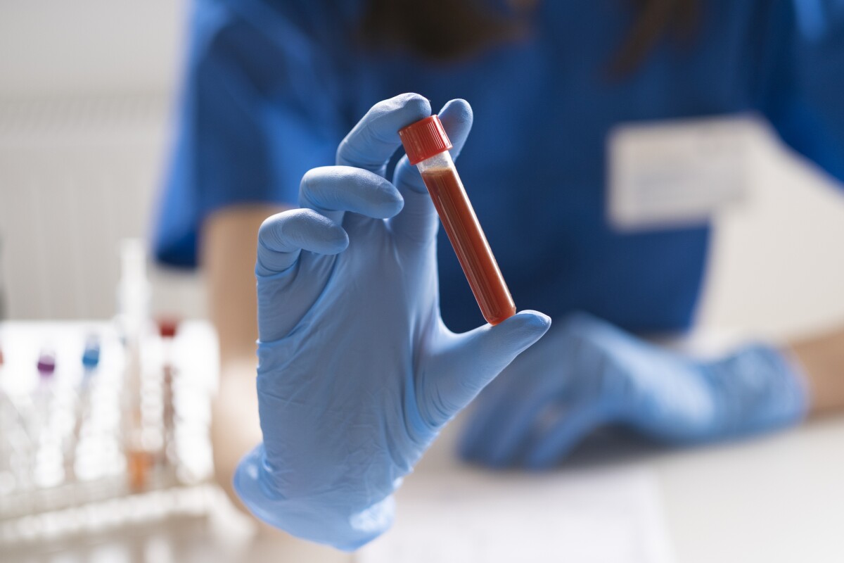 7 important blood tests you probably need