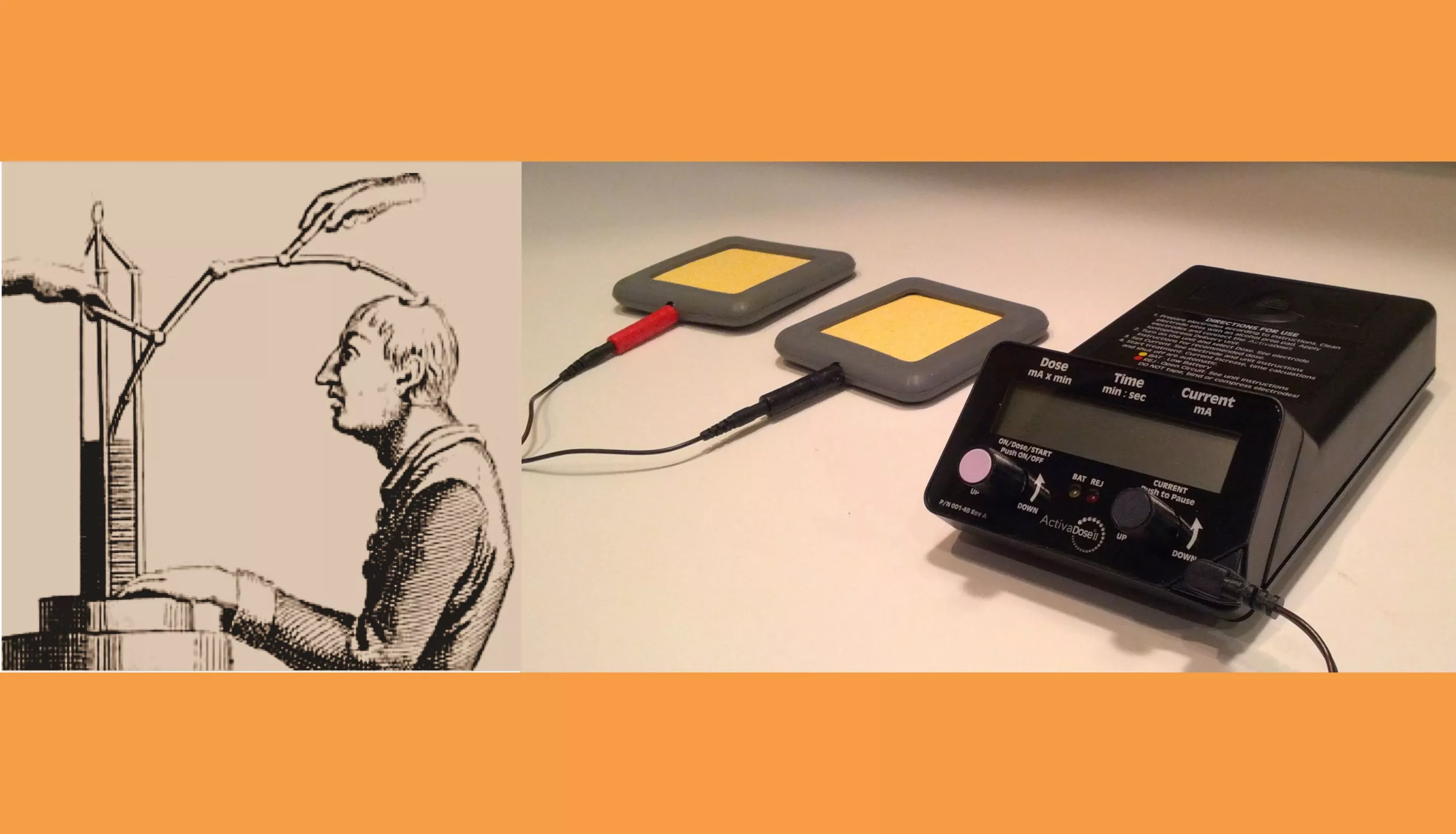 tDCS has come a long way from Giovanni Aldini's 1802 pioneering treatment of Luigi Lanzarini's major depression (left) to a compact modern tDCS apparatus (right) (Photo: johnboy6785)