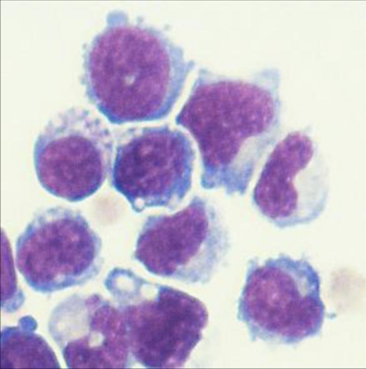 Edited Bone Marrow Cells Trigger Striking Tumor Regression In Mice