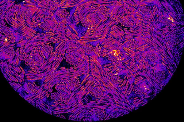 A microscope image of a woven scaffold containing