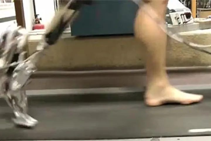 An amputee tests the AMP-Foot 2.0 on a treadmill