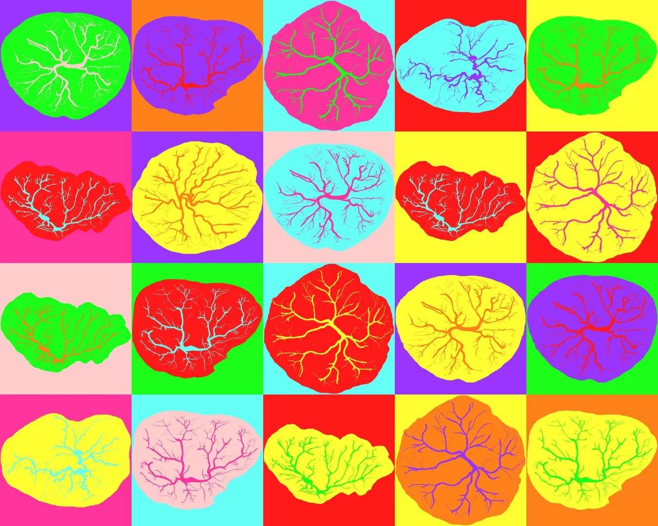 2nd place in the Weird and Wonderful category is a pop-art riff playing on the diversity of shape and appearance in placentas. The images show automatically segmented chorionic vascular trees obtained from high resolution photography