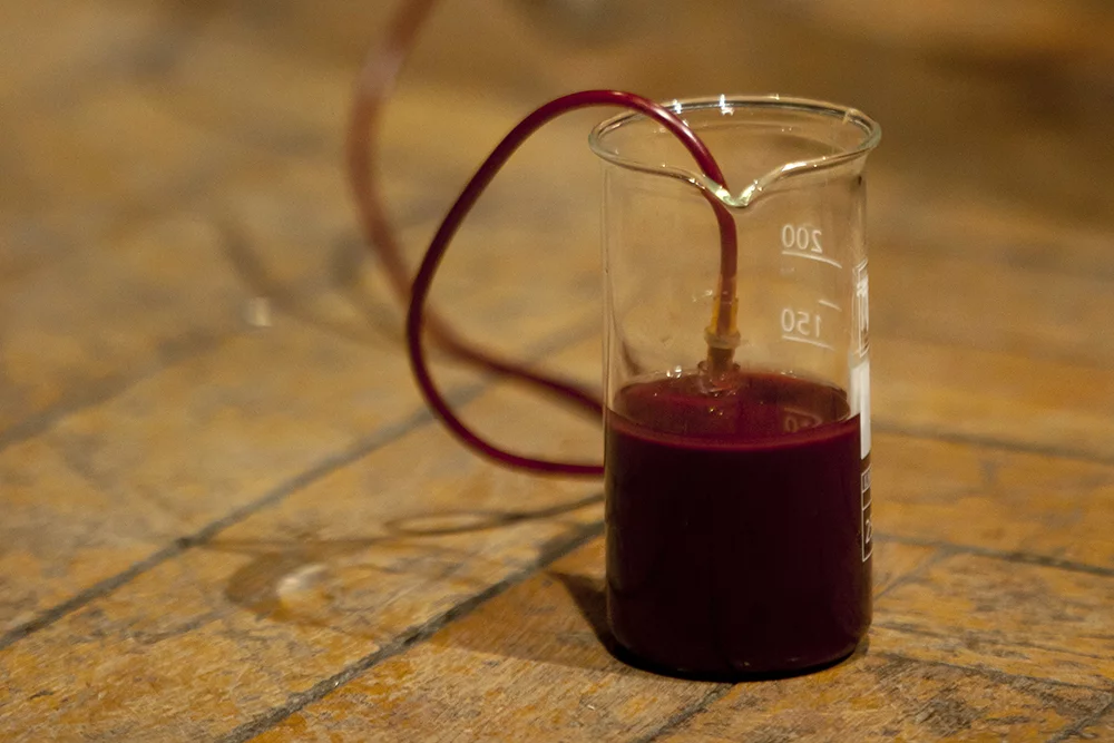 Morozov gradually drained the 4.5 liters (9.5 pints) of blood needed for the project over an 18 month period