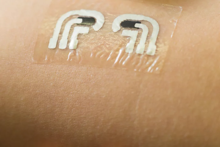 The tattoo measures glucose levels in fluid between the skin cells, which reflects levels in the bloodstream