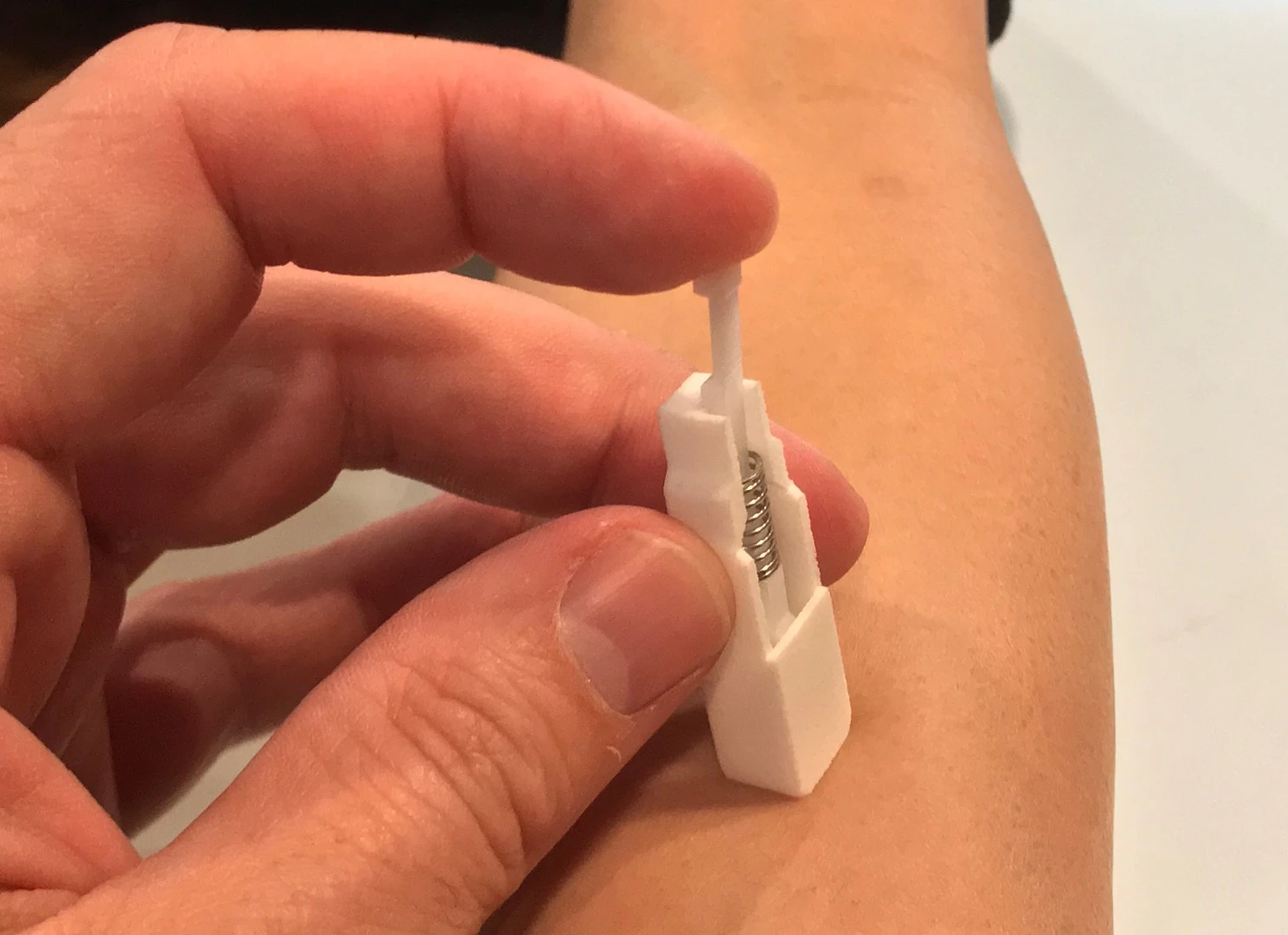 Professor Tarl Prow and his team have developed a prototype of a microbiopsy device, which can take skin cell samples to diagnose cancer painlessly and without leaving a scar