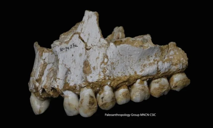 This Neanderthal was found to have several afflictions that would have caused him pain, and traces in his dental plaque indicated he was medicating himself with forms of aspirin and penicillin