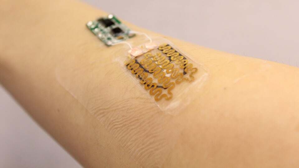 The prototype smart bandage developed at Tufts University