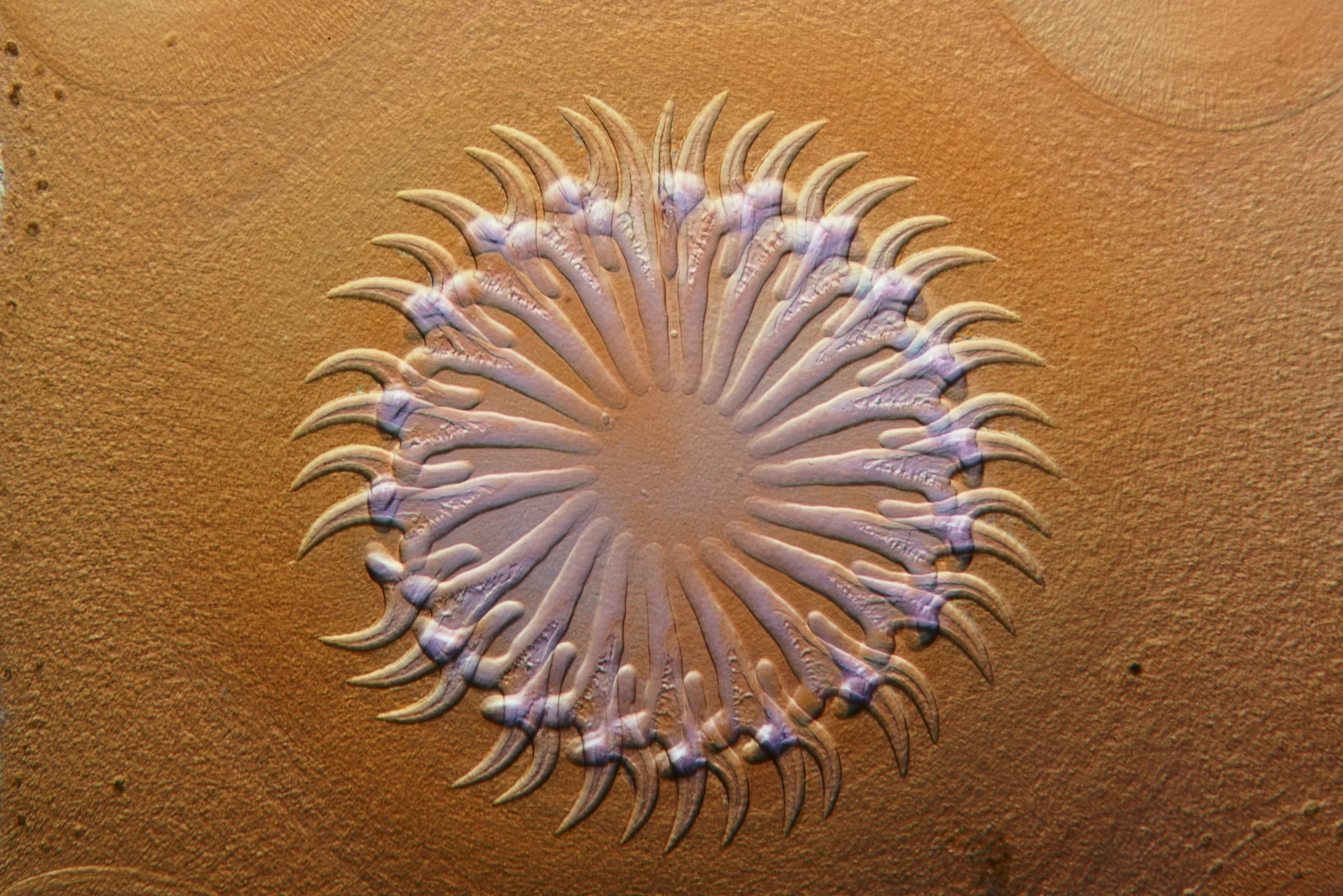 Image of Distinction. Head of a tapeworm (Taenia pisiformis)