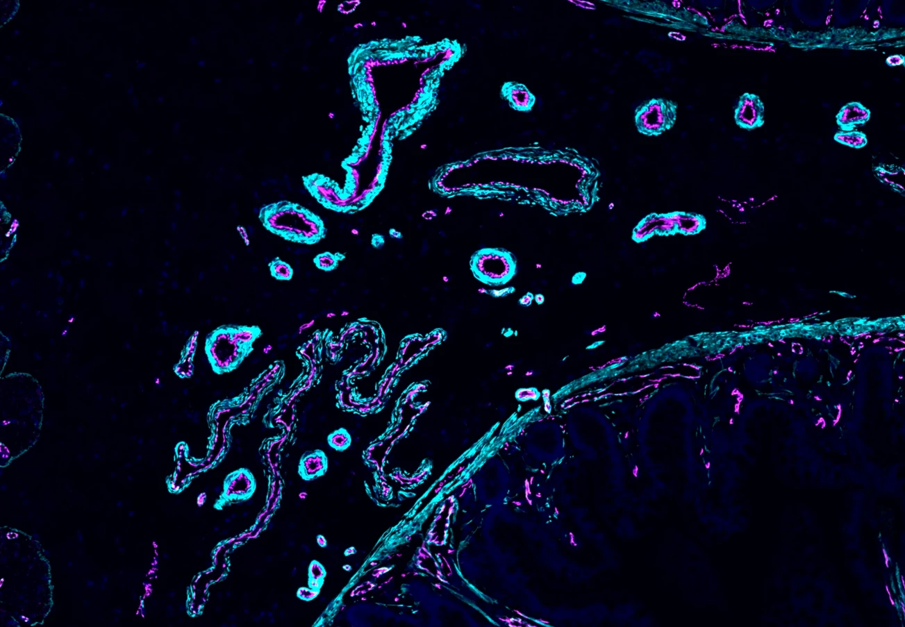 Blood vessels in a human ileum sample. Immunofluorescence staining highlights endothelial cells in magenta, marked by CDH5, and smooth muscle cells in cyan, marked by ACTA2