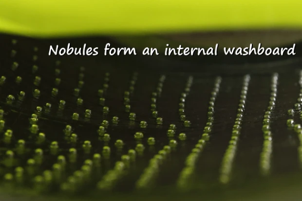 The inside surface of the Wash Pack is what allows it to clean clothes