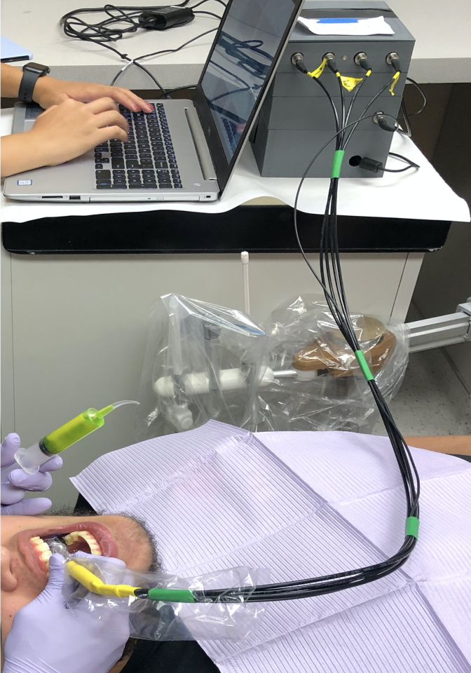 El sistema O-pH mide los niveles de pH para detectar las señales de advertencia de deterioro