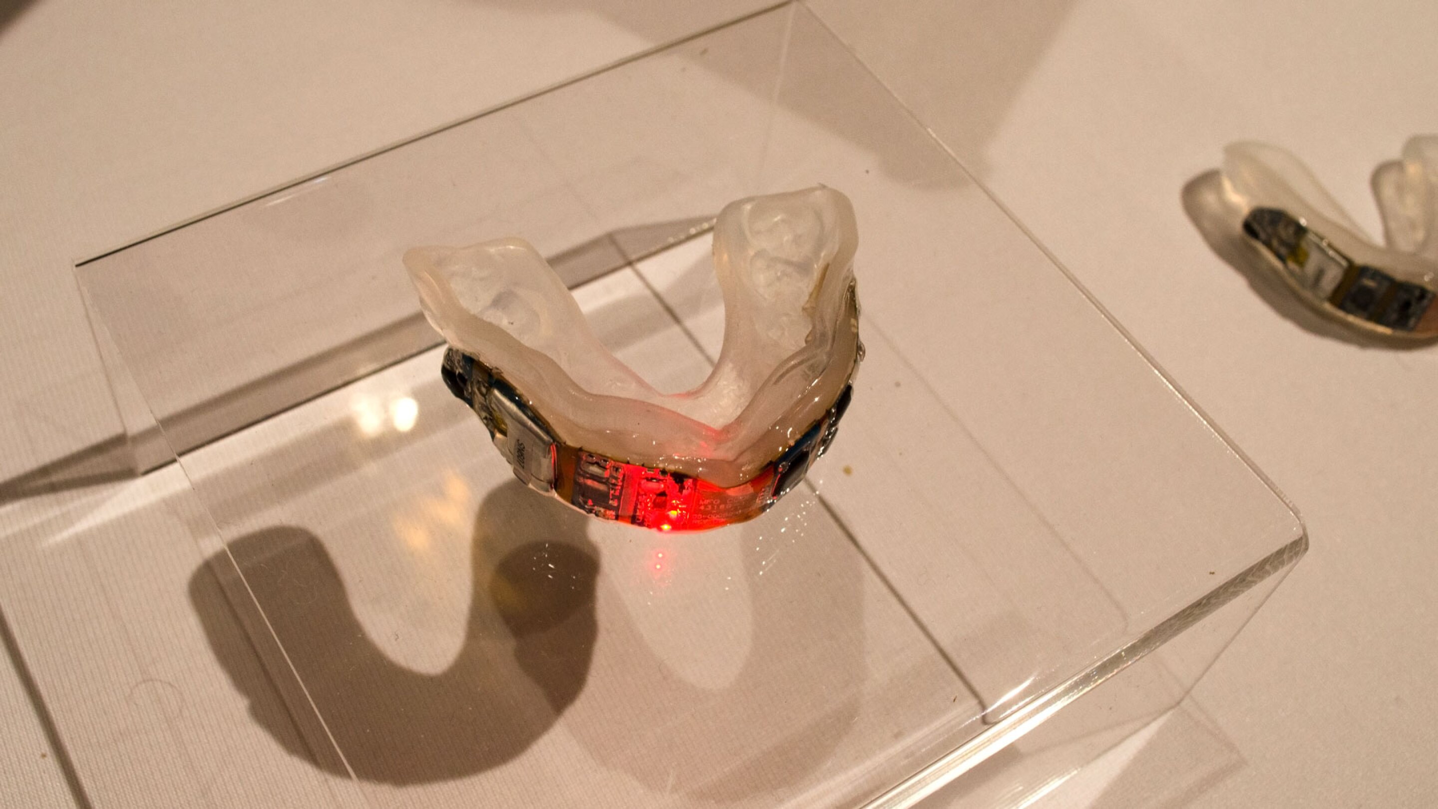 Impactmonitoring mouthguard detects concussion in realtime