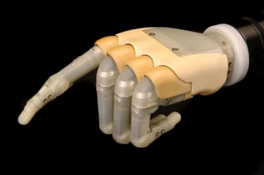 The iLimb hand, from Touch Bionics, demonstrating a finger point.