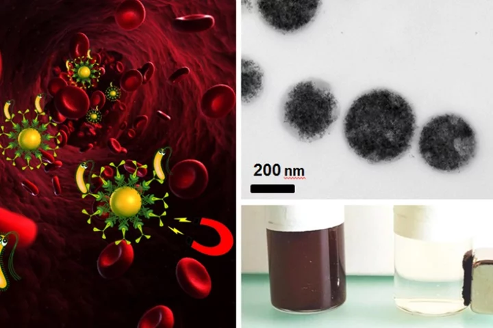 Bacteria can be removed by magnetic blood purification (left) – a suspension with magnetic iron particles (top right) can be "cleaned" using a magnet (bottom right)