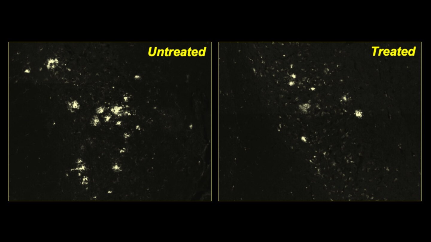Fewer protein clumps can be see in mice treated with a novel drug to boost cellular cleaning