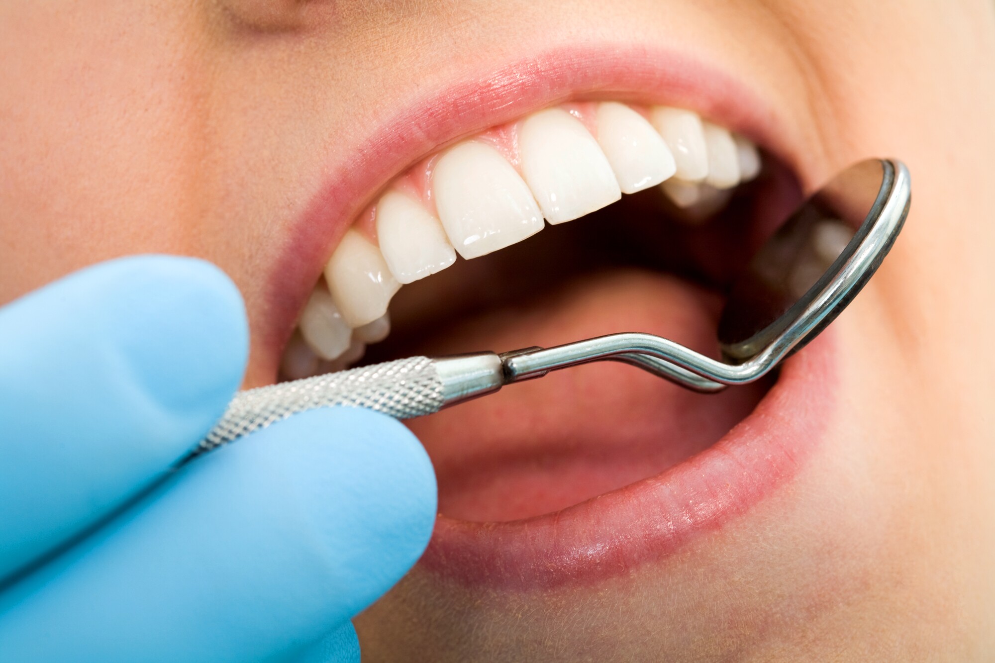 How gum disease can influence heart disease, diabetes and even Alzheimer's