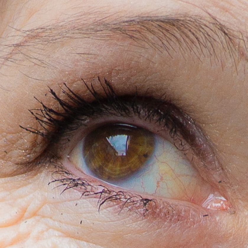 Eye detail from one of the sample images above.