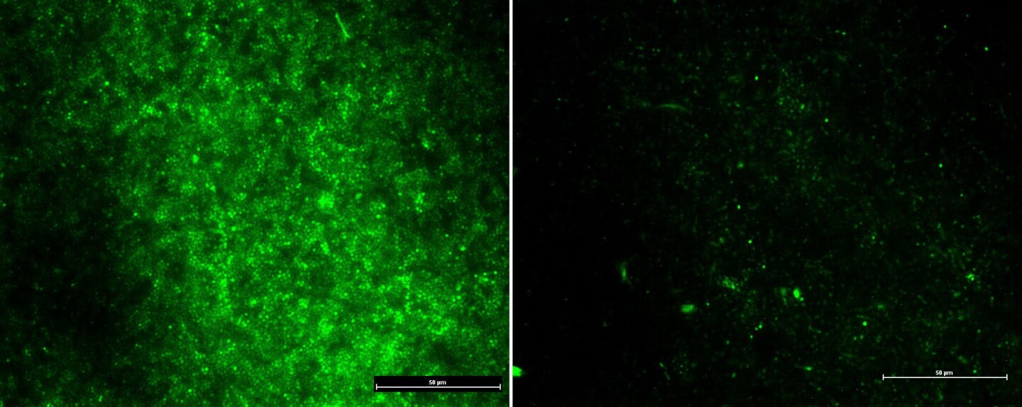 Before (L) and after (R) images show the population of bacteria (green) was drastically reduced following the application of the an electrified scaffold