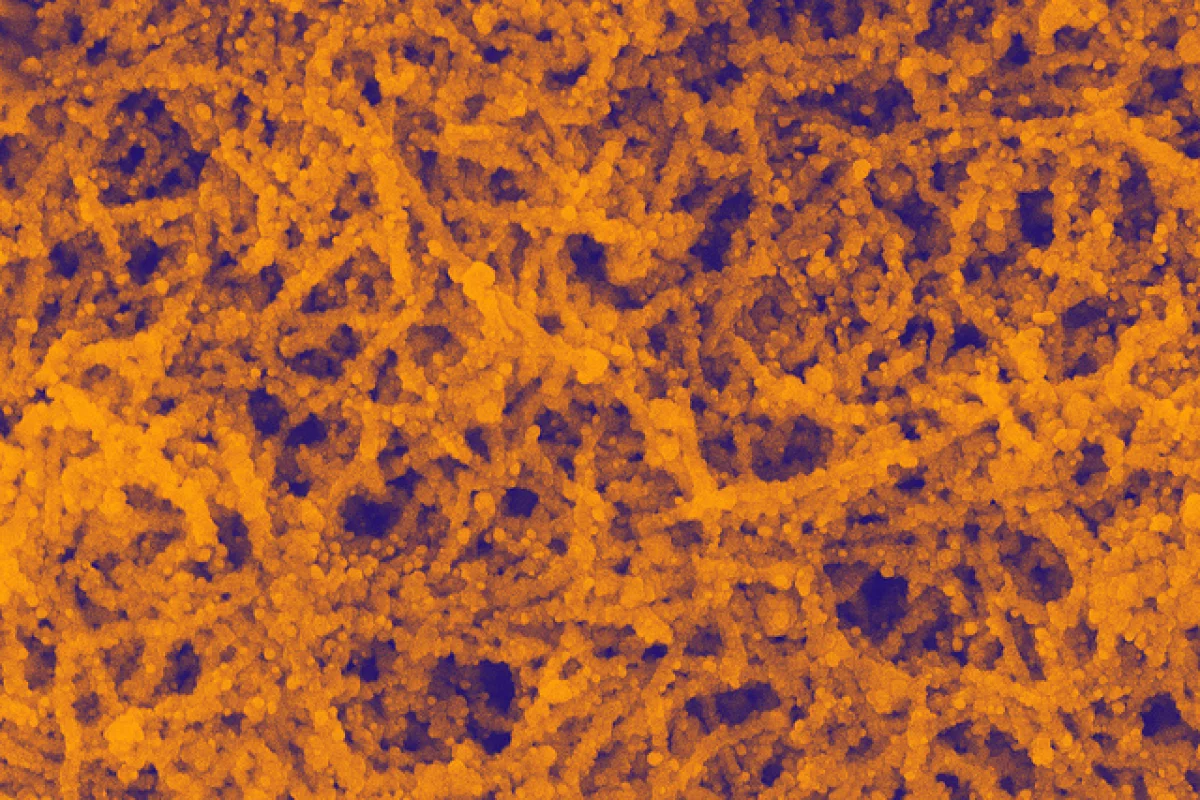 Researchers have boosted the efficiency of organic solar cells by 20 percent through the use of gold nanoparticles (Image: Gold nanoparticles in nanowires - Argonne National Laboratory)