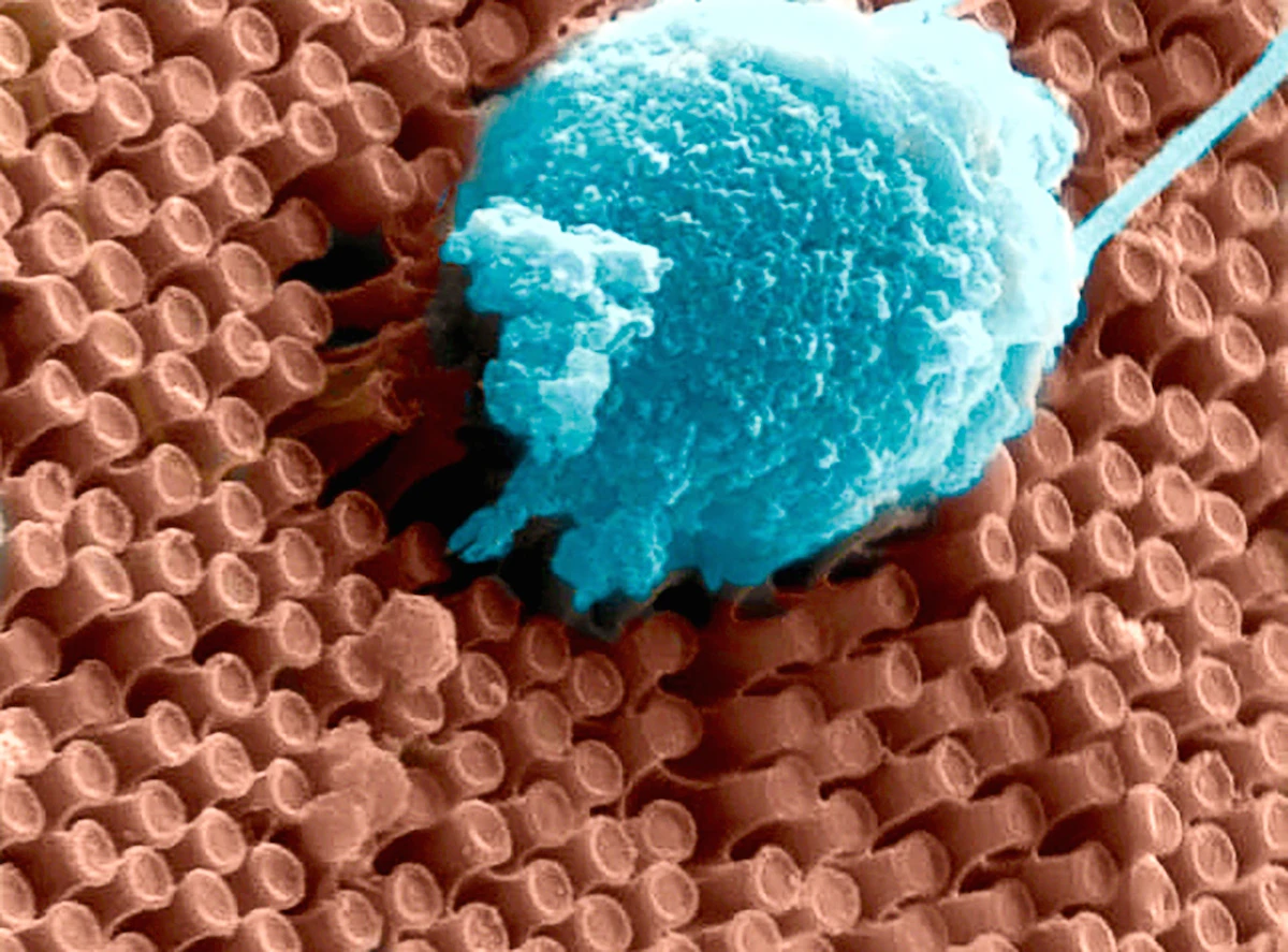 Researchers at UC San Diego have developed a nano-scale retinal implant that could restore sight with higher resolution than other bionic eye systems