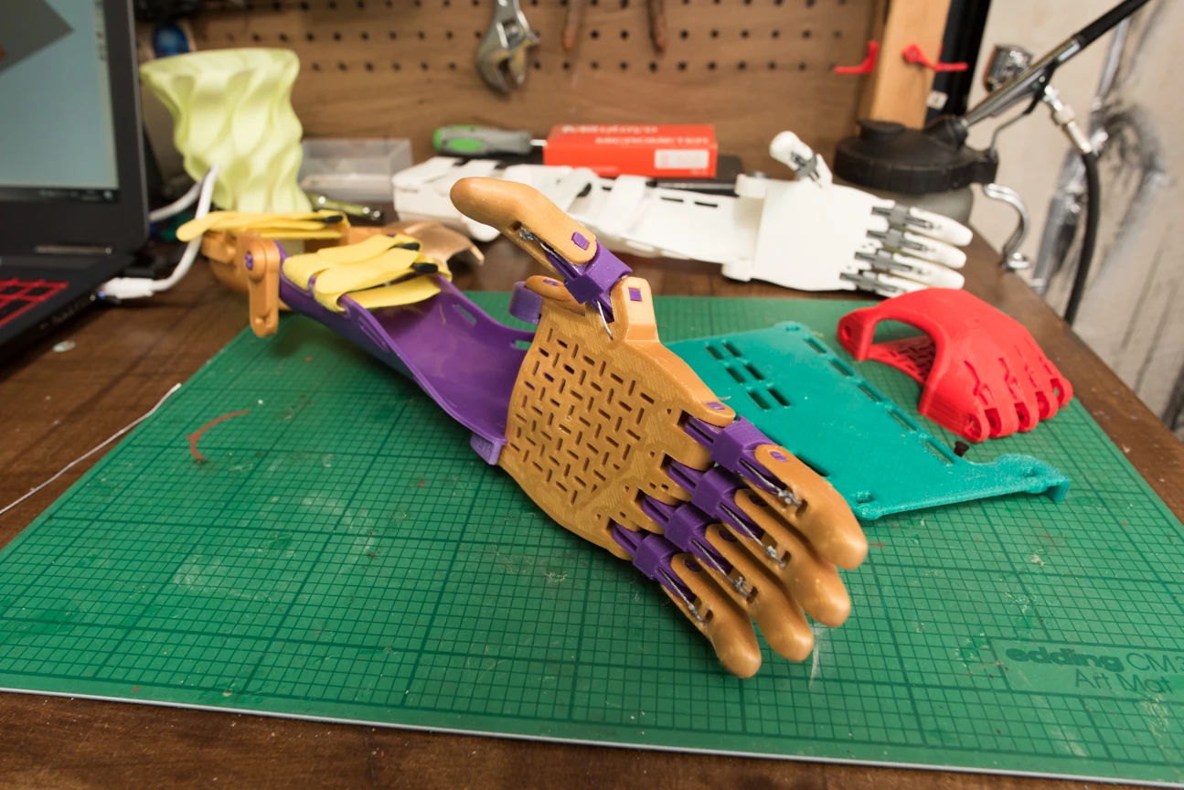 After being born with one hand himself, Stephen set up Team Unlimbited to offer disadvantaged kids a chance for a better prosthetic limb