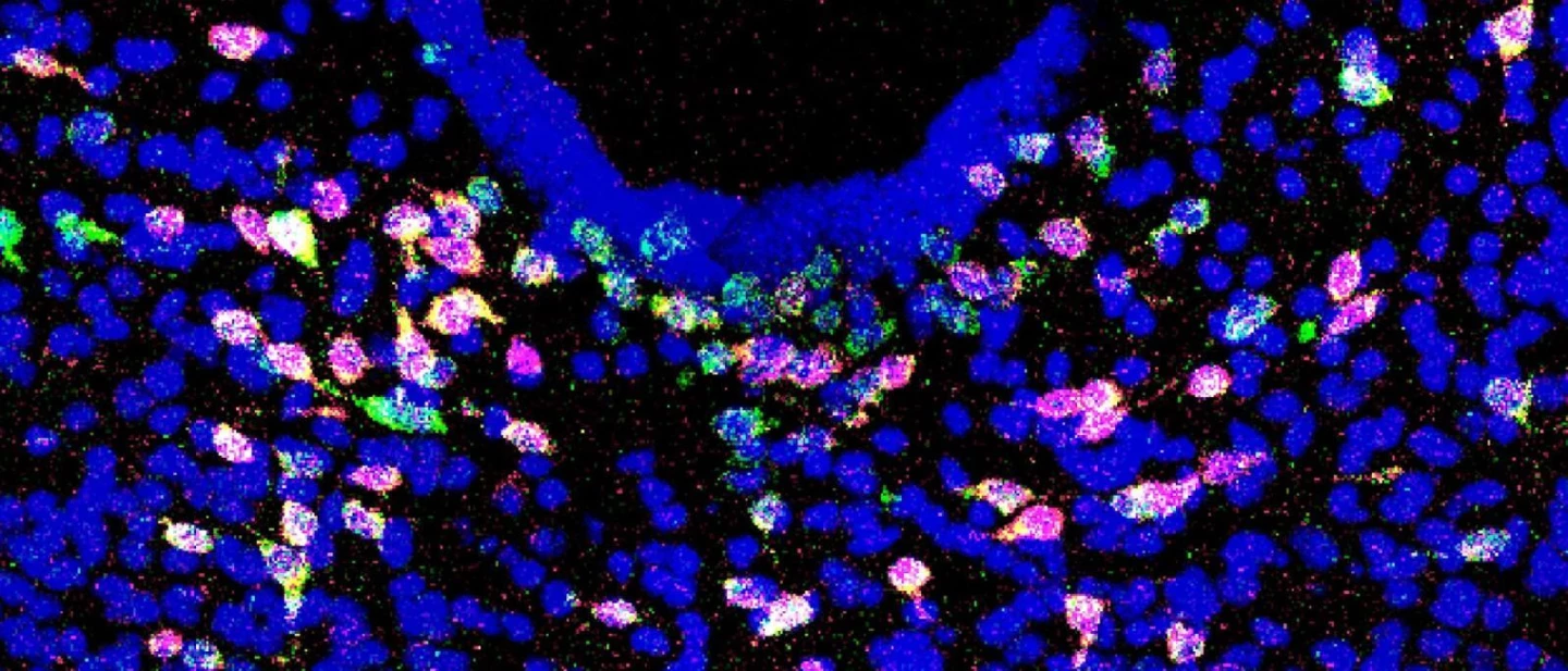 Newly identified neurons (shown in magenta) in the brainstem of a mouse