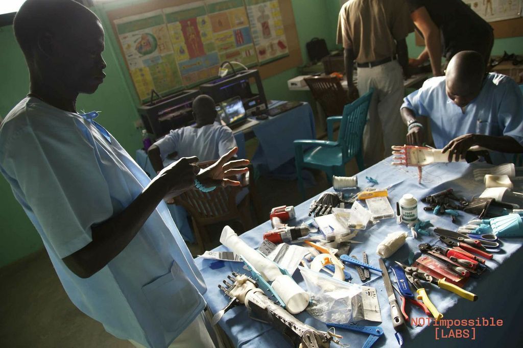 Ebeling and his team setup a workshop in a local hospital and trained local clinicians and doctors to 3D print the prosthetic arms themselves